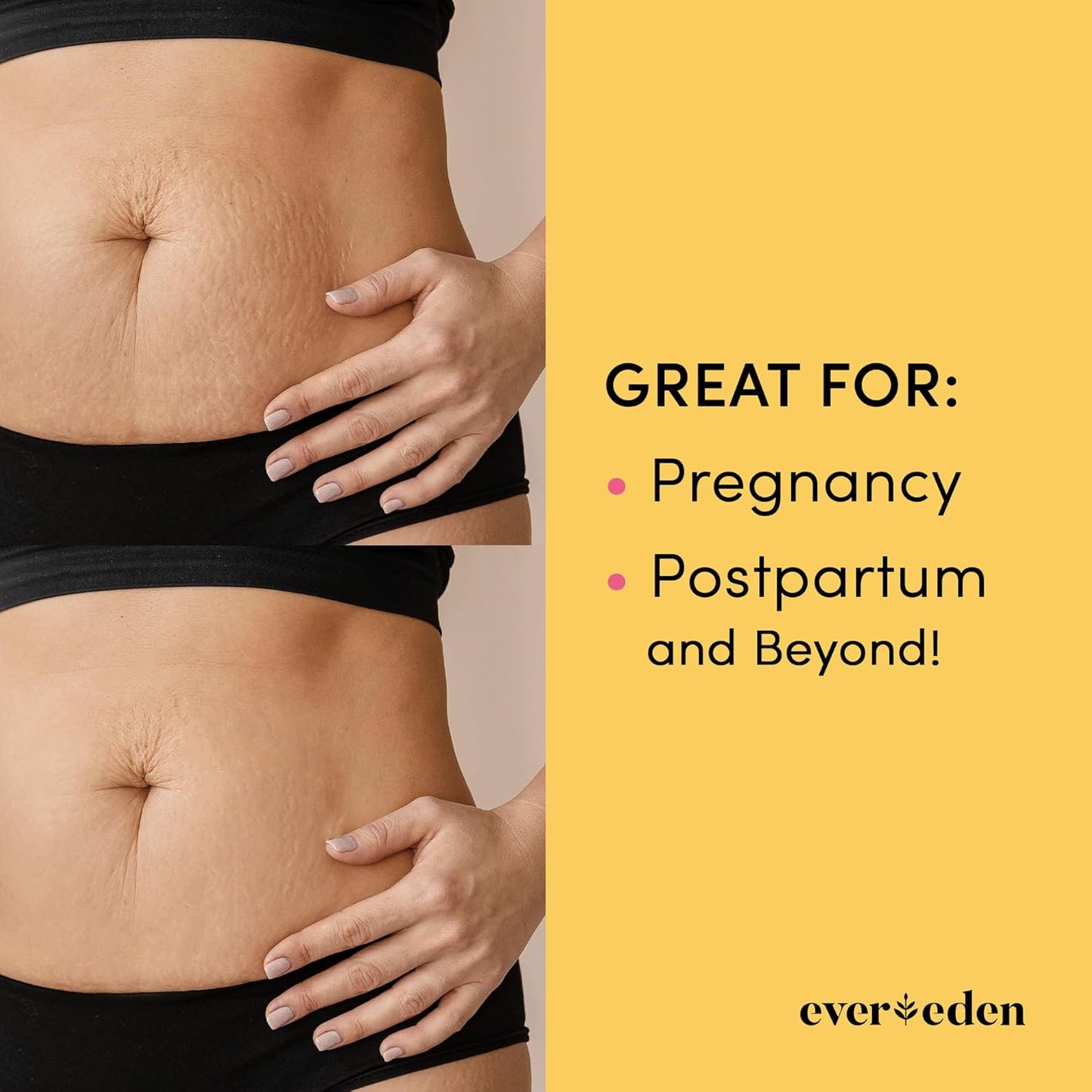 Evereden Nourishing Stretch Mark Cream 50ml | Clean and Unscented Pregnancy Skincare | Stretch Mark Prevention