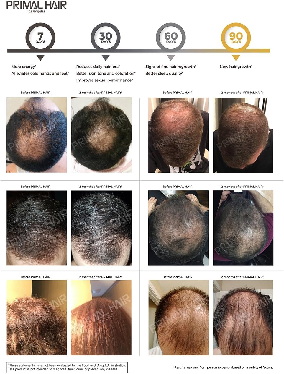 100% Natural Growth Treatment, Reduces Hair Loss, US Patented Formula Proven Effective for Men & Women, 100% Vegan Ingredients, Non-GMO, 30-Day Supply
