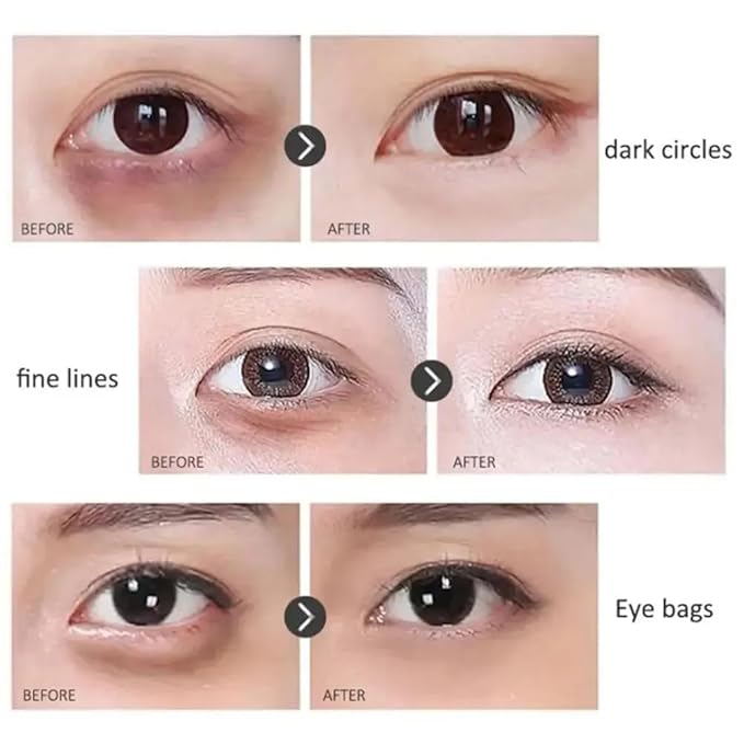 Time Eraser Rollerball, Retinol Anti-Wrinkle Eye Serum Oil, Eye Oil Roller, Reduces Fine Lines, Anti Wrinkle Serum For Eye