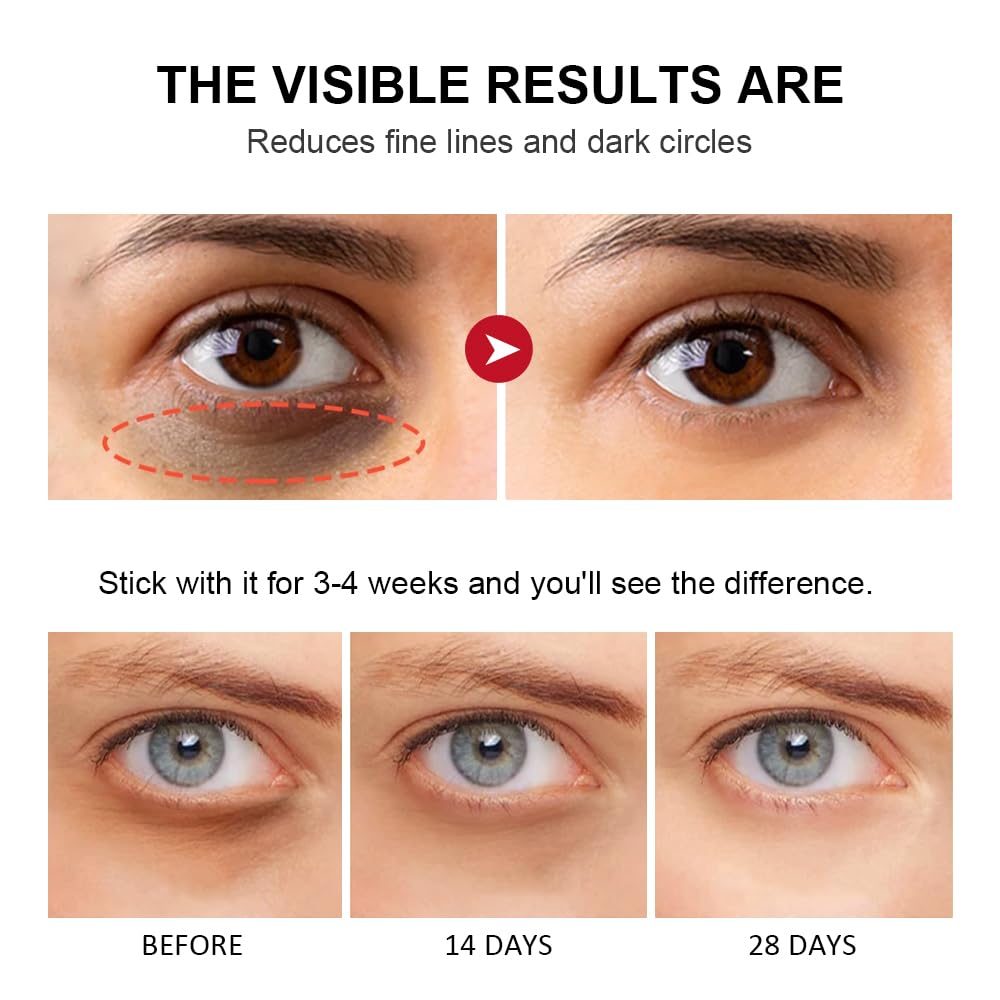 Retinol Eye Stick-Peace Out Dark Circles with this Anti-Aging Eye Cream and Brightening Balm Visible in 3-4 Weeks Reduces Fine Lines and Puffiness, Banishes Wrinkles and Dark Circles under Eye