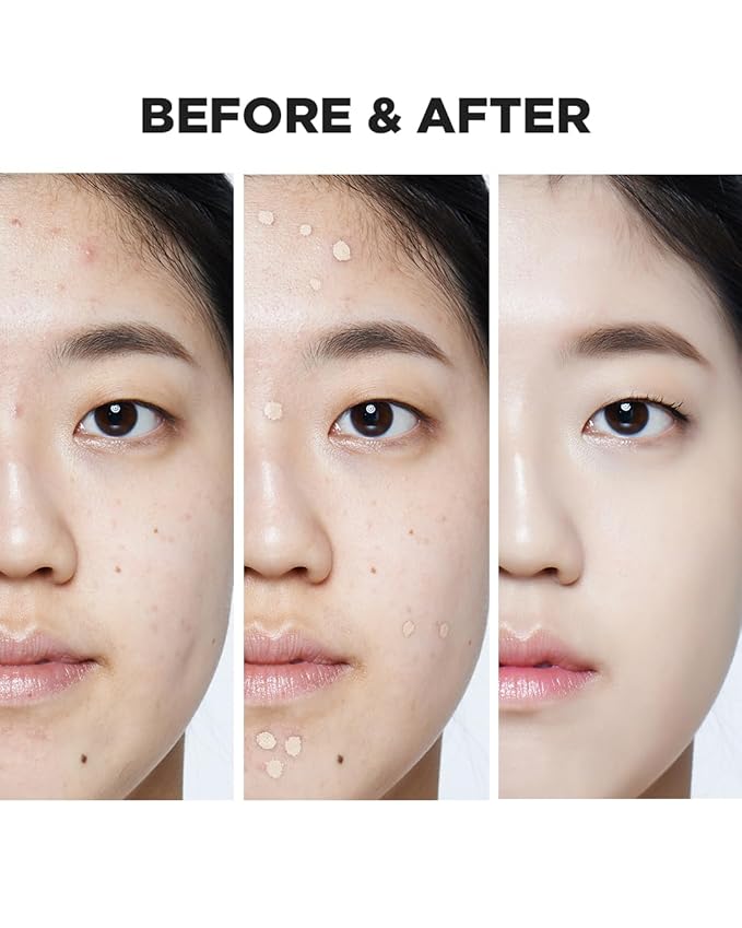 THESAEM Cover Perfection Pot Concealer #01 Clear Beige - High Adherence & Coverage Balm, Conceals Blemish & Acne Spots, Matte Finish Sebum Control for Oily and Combination Skin