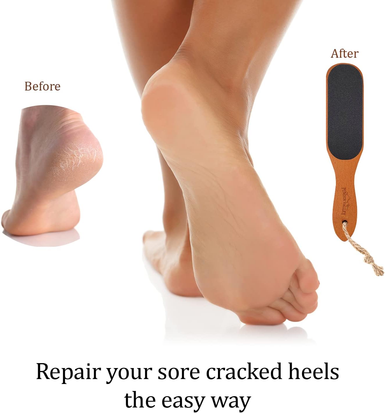 Pumice Stone Foot File - Wooden Pedicure Feet Scrubber with Handle for Callus, Dry, and Dead Skin Removal - Heel Scraper for Feet, Hands, and Body - Foot Filer for Use in Shower