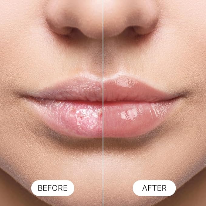 Essential Lip Balm Blue Collagen (HONEY VITA C)