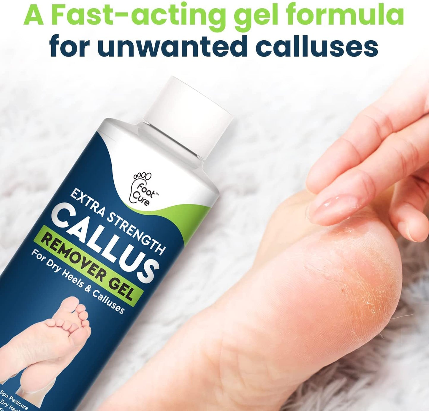 Callus Remover for Feet with Extra Strength Gel & Foot Pumice Stone Set - Easy Way to Remove Hard Calluses & Dead Skin Build-Up - Professional At-Home Foot Care for Men & Women - Made in the USA