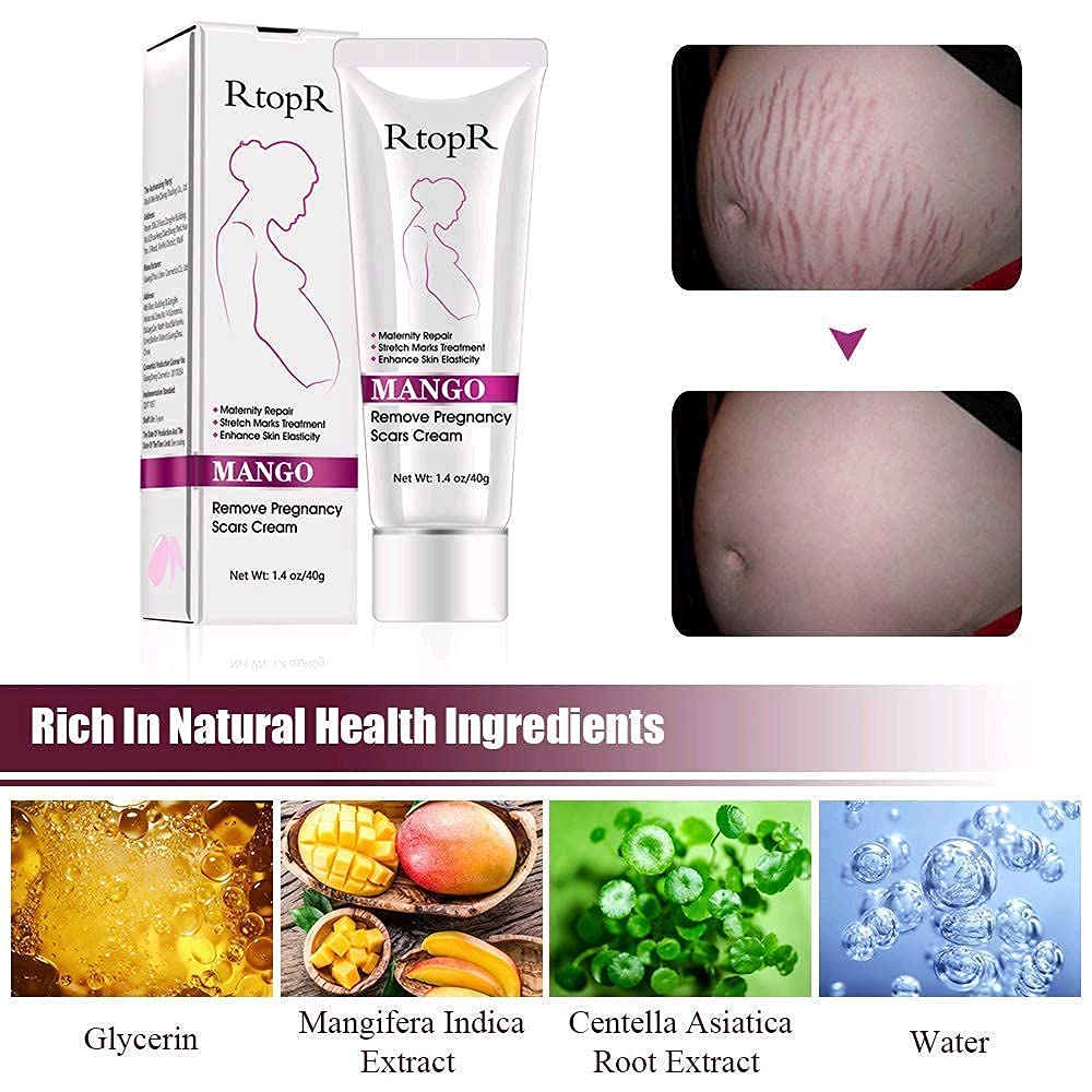 RtopR Mango Stretch Marks and Scar Cream -Stretch Marks and Scar Removal Cream for Pregnancy - Best Body Moisturizer-80g