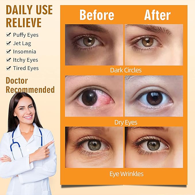 Serfeymi 22 Packs Steam Eye Masks Self Heating Warm Eye Mask, Disposable Eye SPA Heated Eye Mask for Sleeping, Relieve Eye Fatigue, Gifts Mother's Day -Unscented(11PCS)+ Chamomile(11PCS)