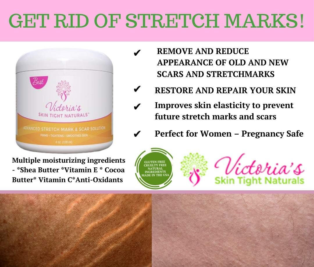 Best Stretch Marks Cream Prevent & Reduce Marks Reduce Pregnancy Stretch Marks Highly Concentrated Cream includes $29 Scar Reducing Guide