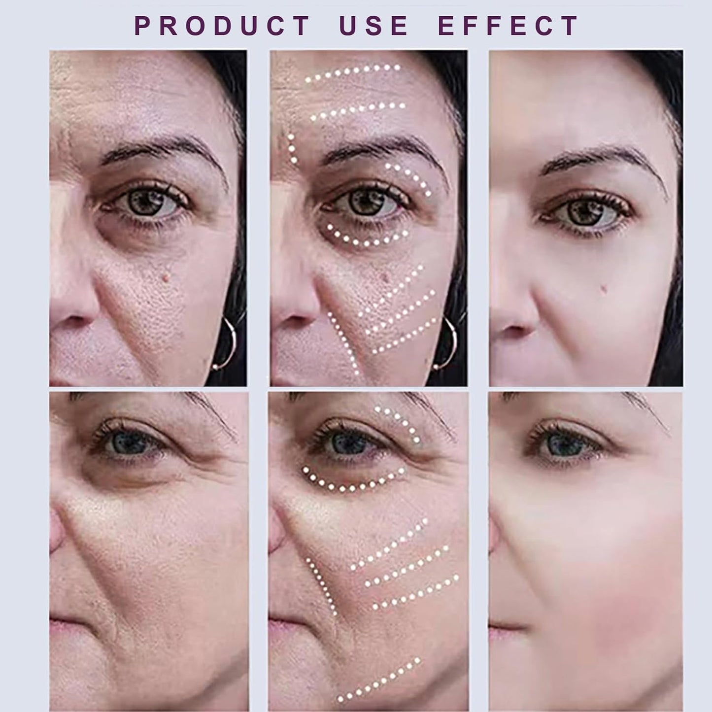 Xylane Eye Cream, Pro-Xilane 20g Anti-Aging Active Eye Repair Cream for Anti-Oxidation, Fade Fine Lines around Eyes, Remove Dark Circles