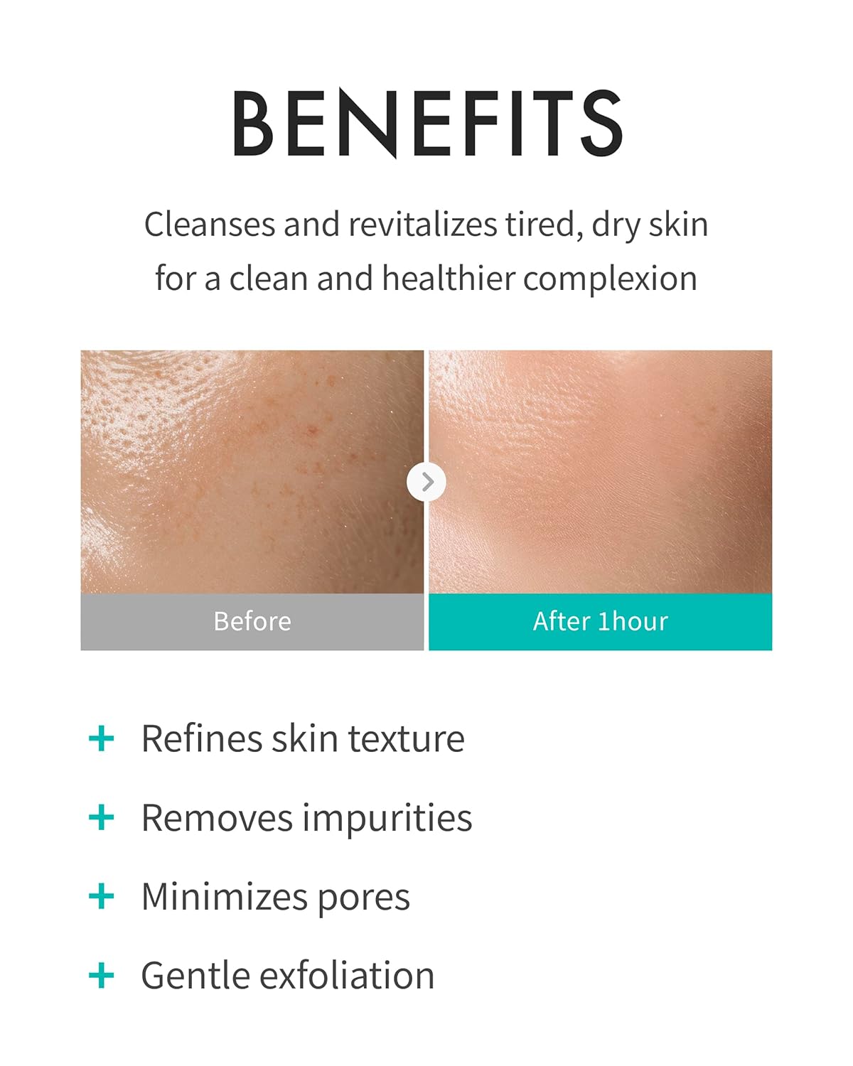 REJURAN® Refining Foam Cleanser, c-PDRN® – Hydrating & Gentle for Smoother, Clearer Skin, Minimizes Pores & Balances with Hyaluronic Acid & Tanin Complex, Korean Skin Care (4.05 fl oz)