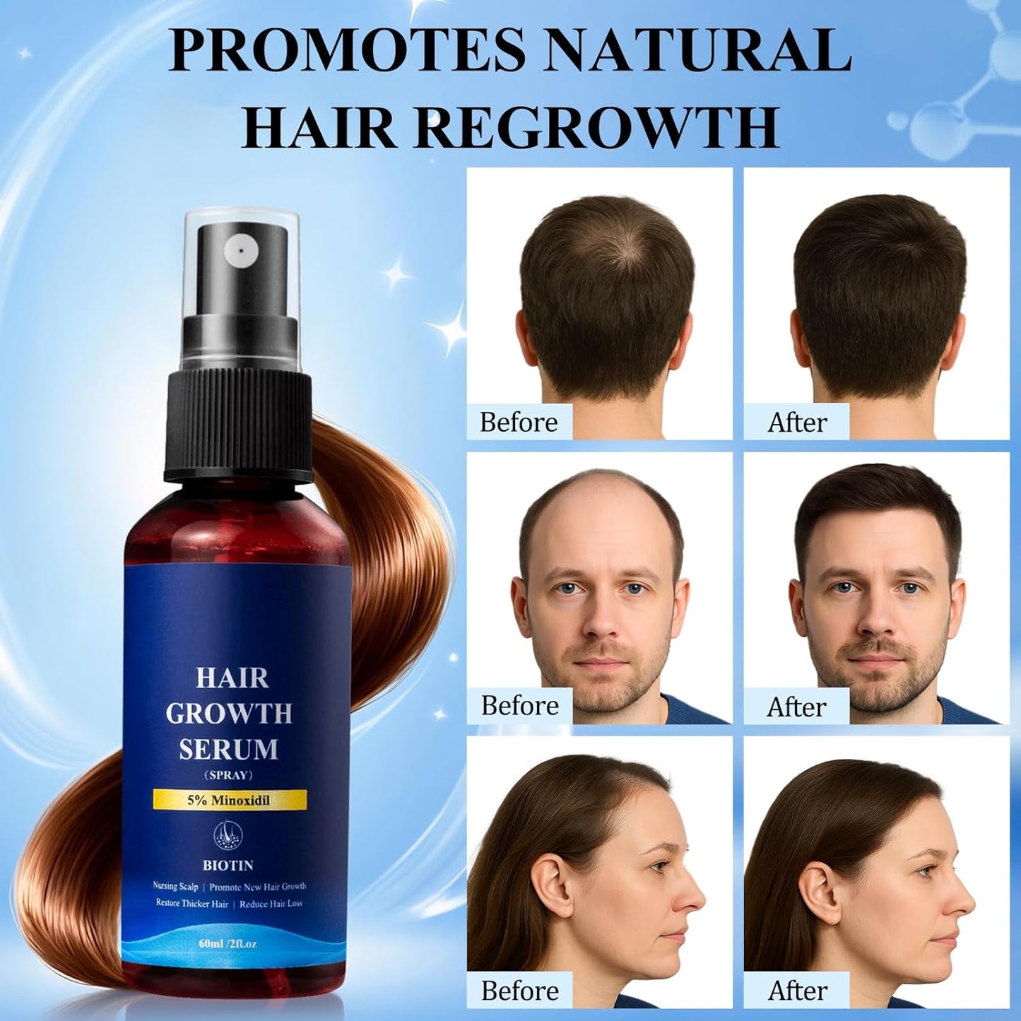 5% Minoxidil Hair Growth Spray - Minoxidil for Men and Women Hair Growth, Hair Regrowth Treatment for Stronger Thicker Hair (60ml)