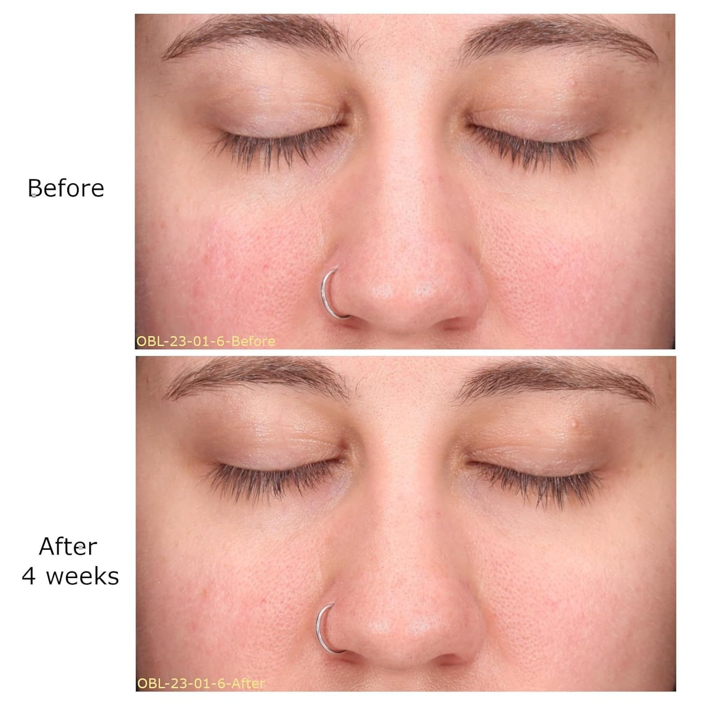 Decongest & Clarify System Collection, Activator with Clarity Facial & Azelaic Acid Concentrate, Skin Revitalizers, Care Routine, Suitable for Oily Skin, Gift Bundle / Starter Kit