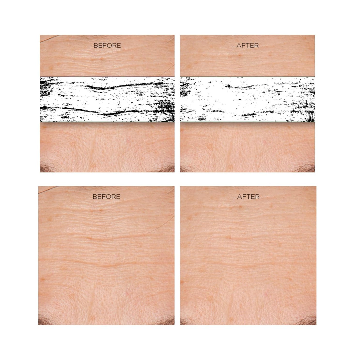 Rejuvenation Serum for Line Lifting and Crow's Feet