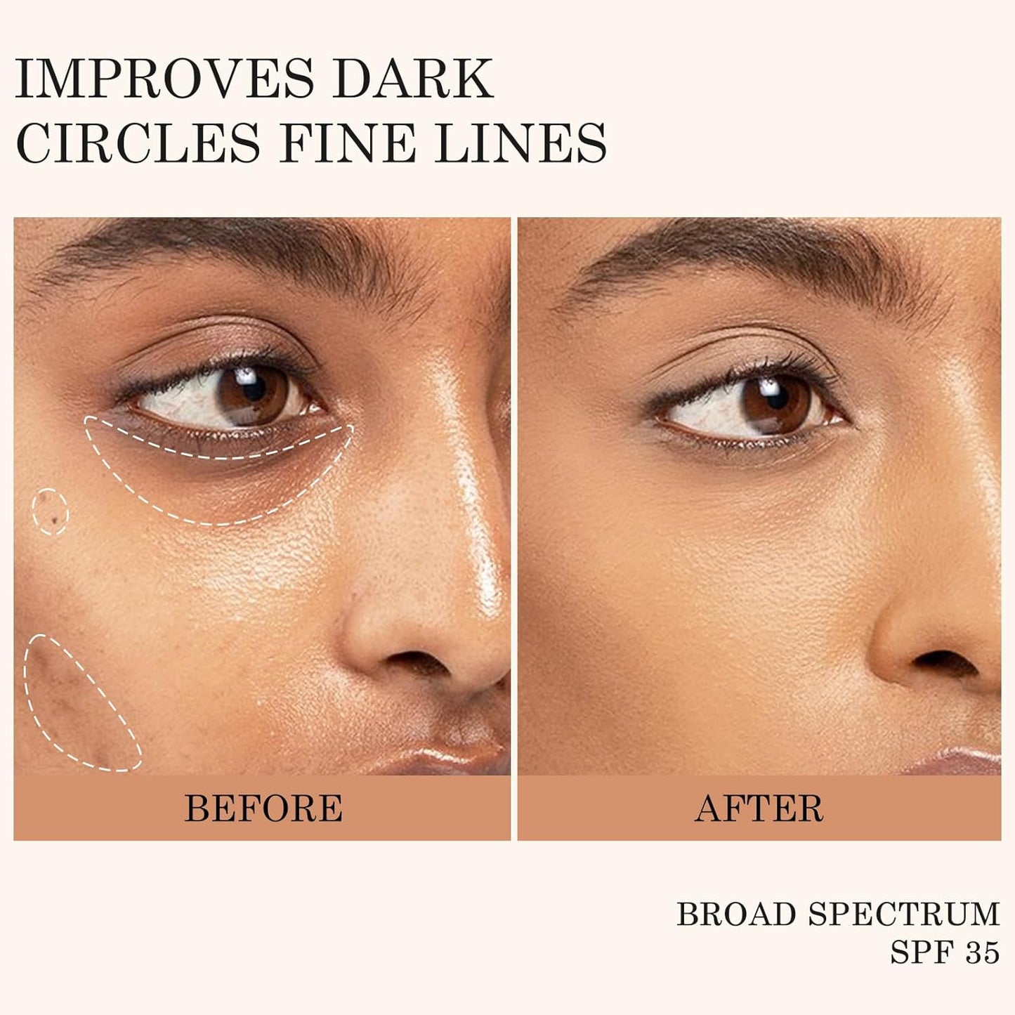 KYDA Mineral Sunscreen Eye Cream, SPF 35, 3-in-1 Under Eye Cream for Dark Circle and Fine Lines