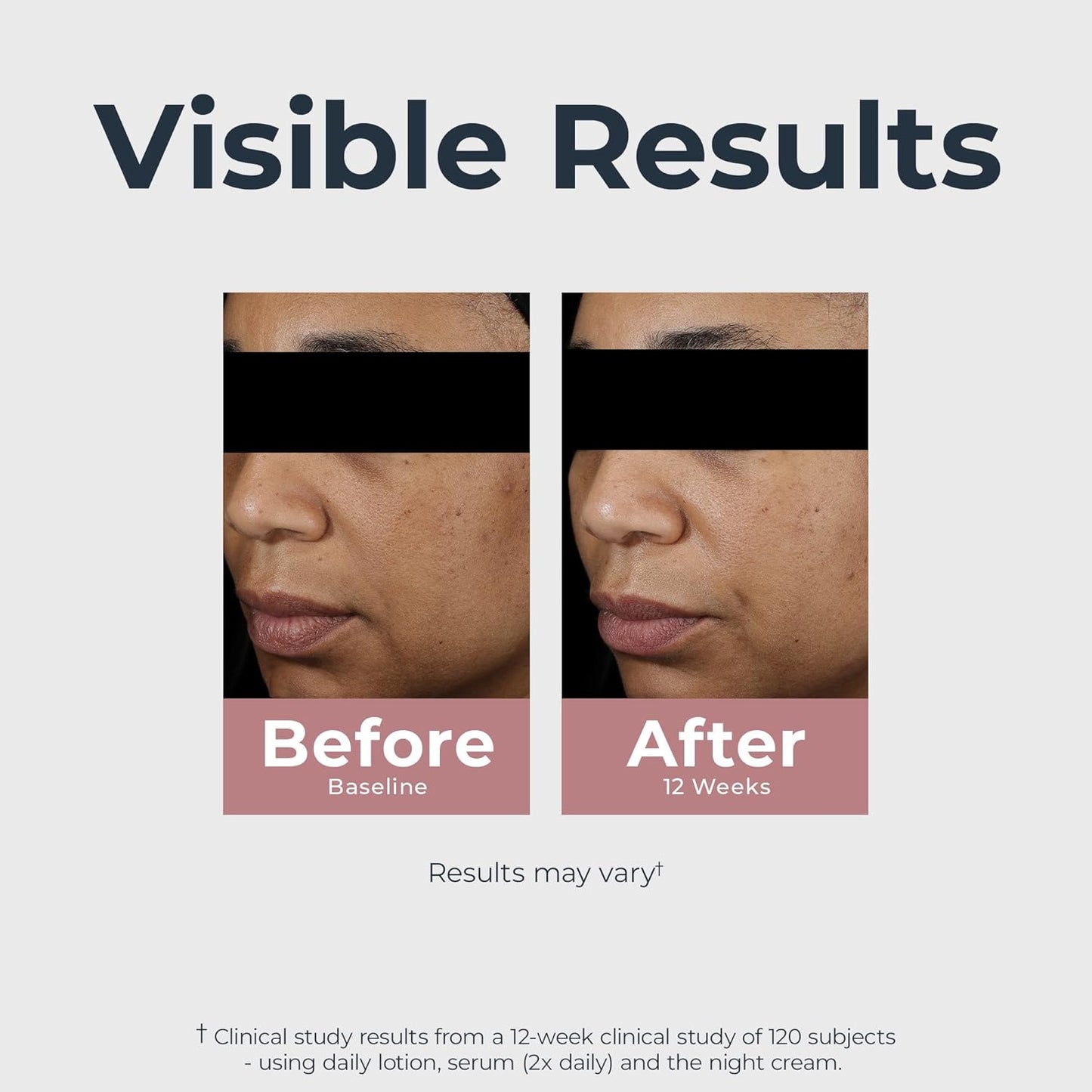 Eucerin Radiant Tone Dual Serum Dark Spot Corrector, Dark Spot Serum with Thiamidol and Hyaluronic Acid, Helps Visibly Reduce the Look of Persistent Dark Spots, 1 Fl Oz Bottle