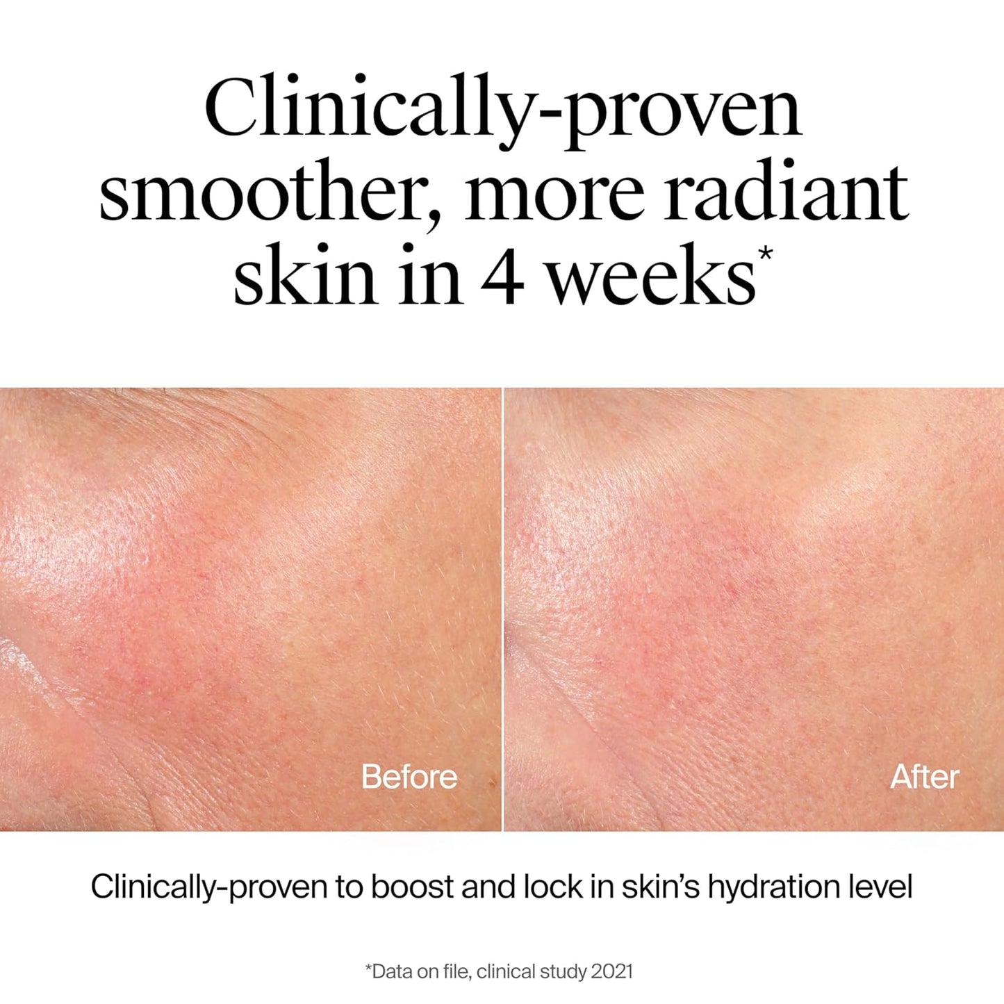 Neutrogena Hydro Boost Hydrating Face Wash & Makeup Remover, Gentle Facial Cleanser Gel with Hyaluronic Acid, Locks Moisture for Soft Supple Skin, Hypoallergenic, Oil-Free, Soap-Free, 7.8 fl oz