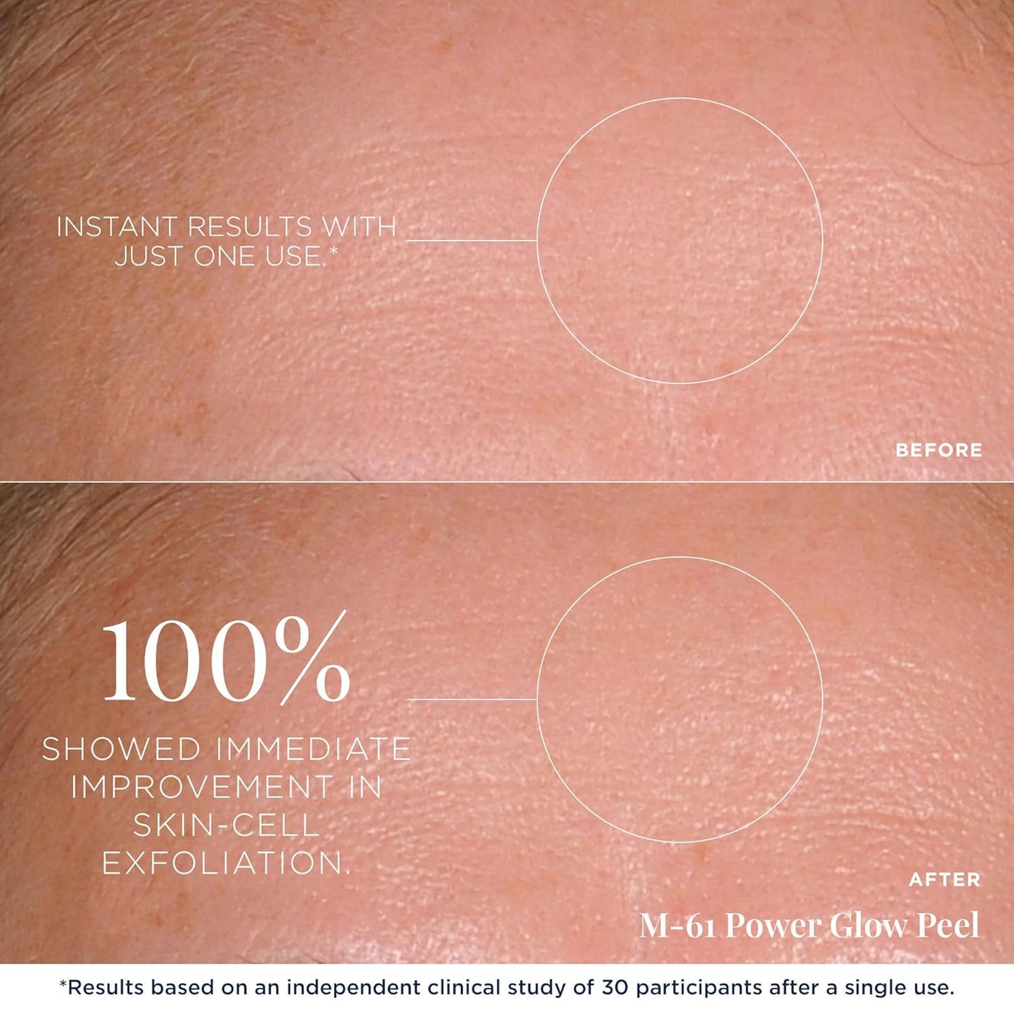 m-61 PowerGlow Peel | Exfoliating Facial Peel With Glycolic, Salicylic Acid. 1 Minute, 1 Step - 30 Treatments