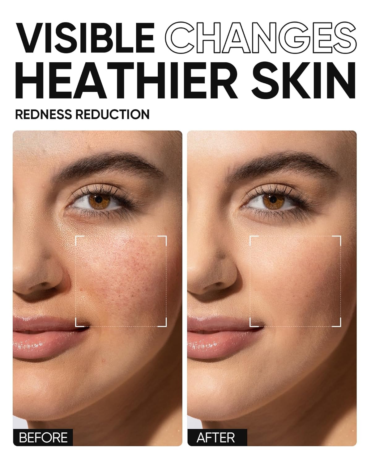 5X Ceramides Moisture Barrier Cream, Hydrating Skin Barrier Repair Face Moisturizer for All Skin Types with Hyaluronic Acid & Centella, Daily Moisturizer, Non-Comedogenic